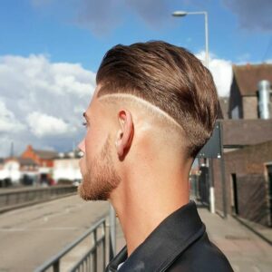 Hair transplant